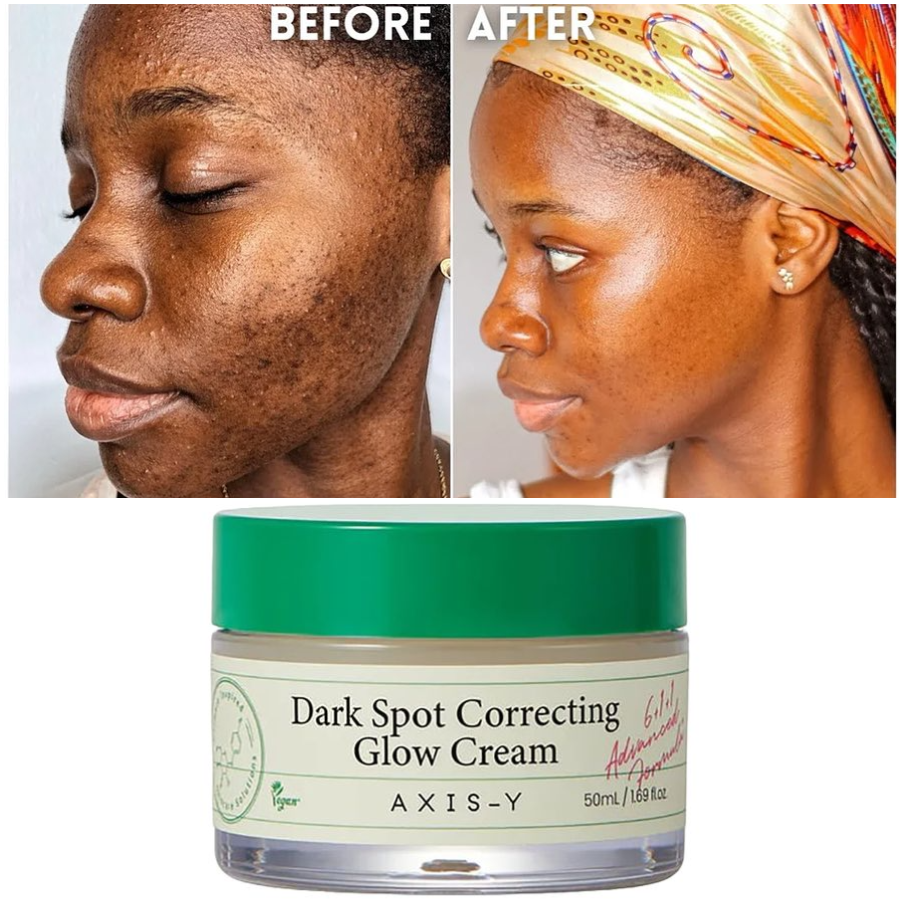 AXIS-Y Dark Spot Correcting Glow Cream Brightening Hydrating Cream That Targets Dark Spots And Restores A Radiant Even Complexion