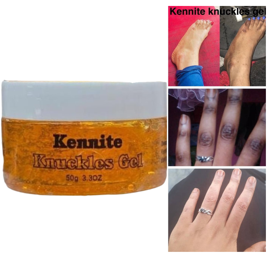 Kennite Fast Action Knuckles Brightening Gel For Dark Knuckles Elbows Knees And Spots Visible Results In 5 Days Intensive Brightening Gel That Lightens Dark Knuckles And Restores A Smooth Even Skin T