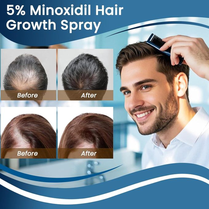 Carvenchy Minoxidil Hair Regrowth Treatment 5% With Biotin Advanced Hair Growth Solution High Potency Formula To Strengthen Roots Reduce Hair Loss And Promote Thicker Fuller Hair