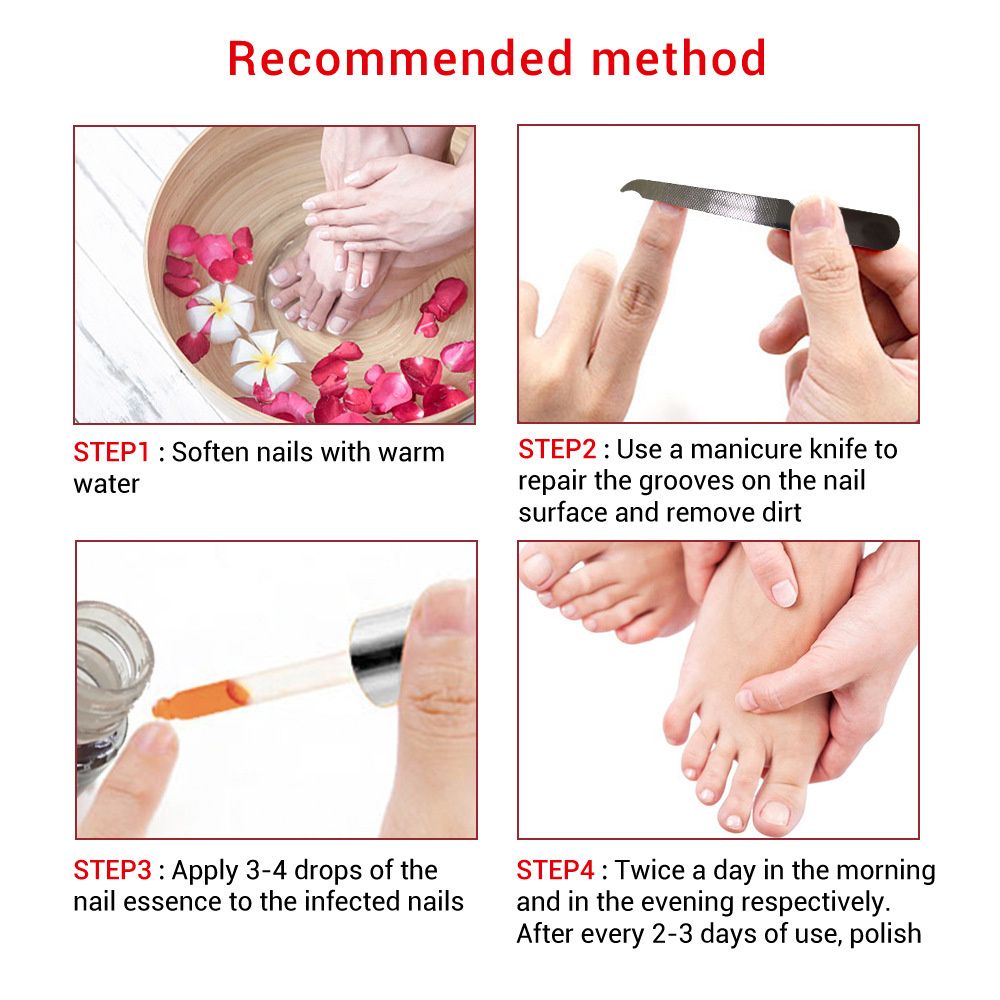 LANBENA Nail essence with small file 12ml