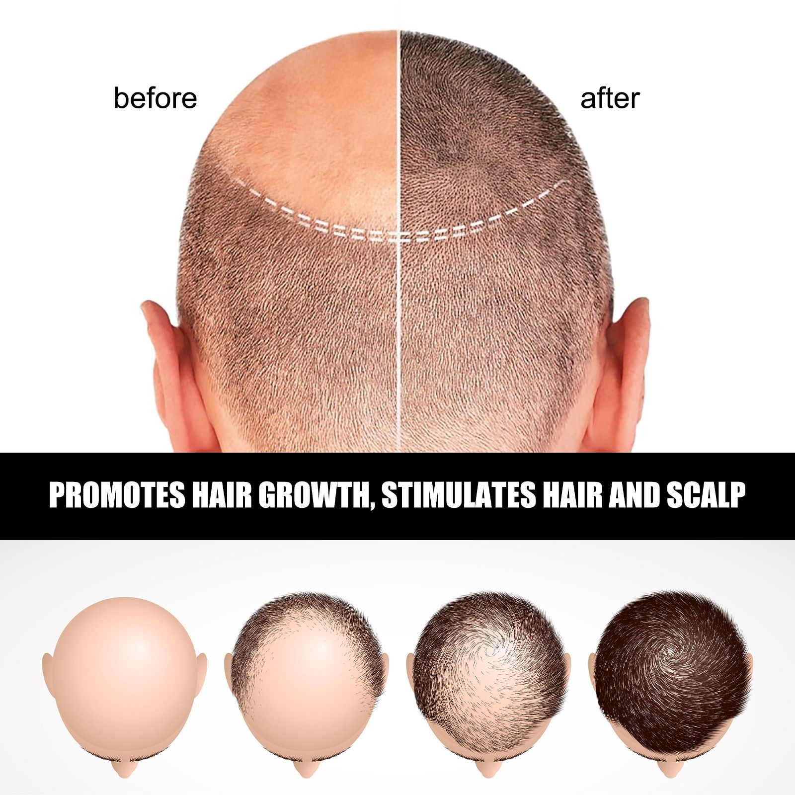 Jayswing hair ampoule essence lotion strong, nourishing and growing essence hair firming and strong hair root essence