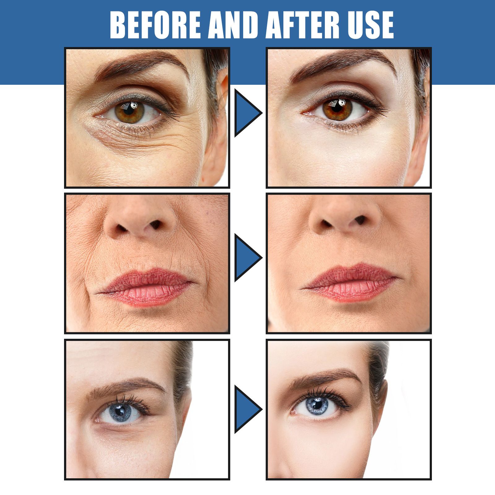 West Month 5-Second Retinol Cream Elastic Skin Moisturizing and Hydrating Cream Softens Skin