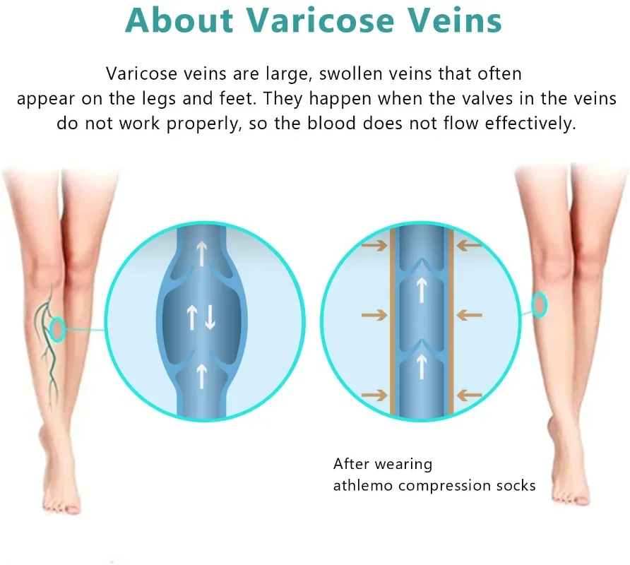 Slimming Compression Pantyhose 15-20mmHg Opaque Firm Support Medical Graduated Compression Stockings for Edema Support