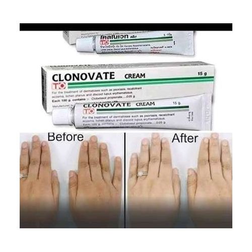 Clonovate Skin Lightening Cream-15g Very Effective