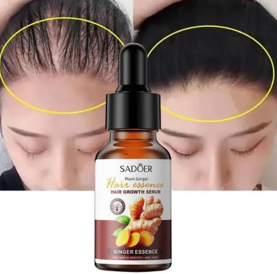 Sadoer Hair Care Serum, Hair Essence  Ginger Hair Growth Based Product, Effective in Hair Growth,Moisturizing and Softening Forked Hair