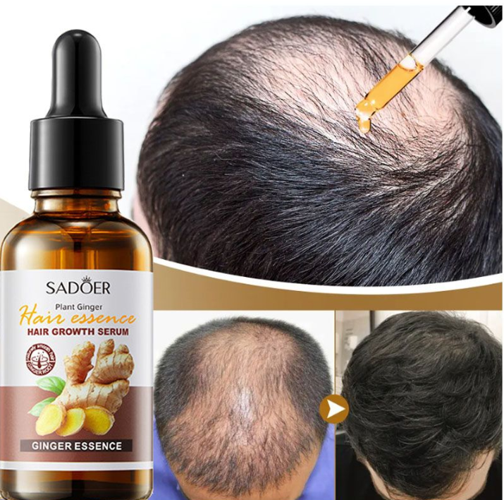 Sadoer Hair Care Serum, Hair Essence  Ginger Hair Growth Based Product, Effective in Hair Growth,Moisturizing and Softening Forked Hair