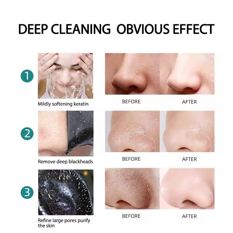 15pcs Blackhead Nose Strips Deep Cleansing Nasal Spot Facial Dot Stickers Nose Mask Shill For Acne & Black Head