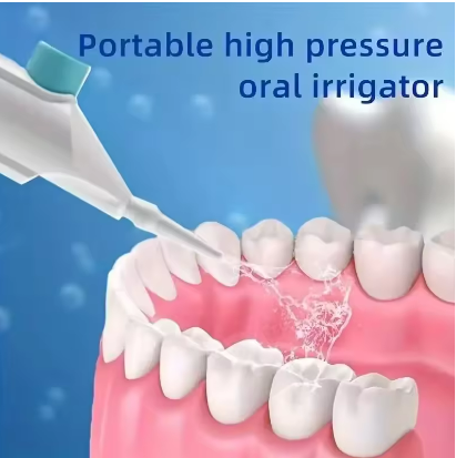 Household High Pressure Oral Irrigator Portable Teeth Clean Water Dental Floss Manual High Pressure Water Toothpick