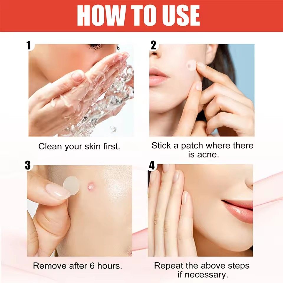 200pcs Repair Acne Patch Facial Skin Care Fade Blemishes Pimple Marks Closed Acne Blemishes Cover Acne Pimple Repair Patch