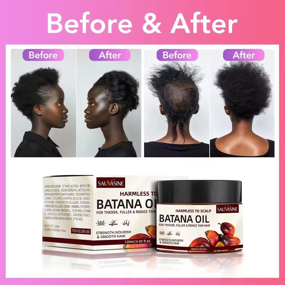 Raw Batana Oil For Hair Growth 100% Pure And Natural Batana Oil For Treating Hair Loss Anti-Breakage Hair Loss Treatment