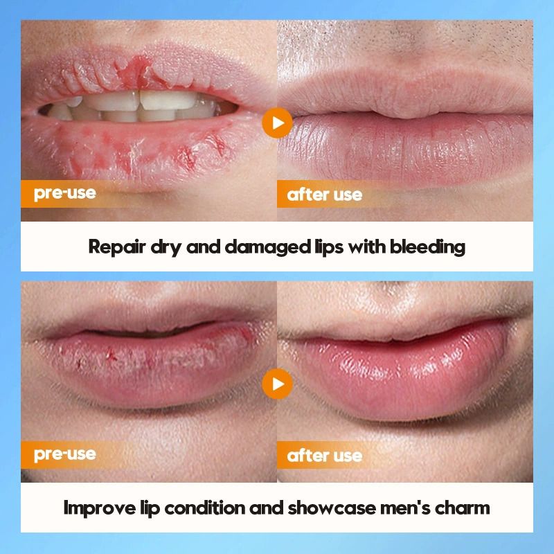 SADOER Men's Lip Balm Moisturizing Anti Cracking Repair Nourishing Hydrating Lipstick Men Lips Skin Care Products