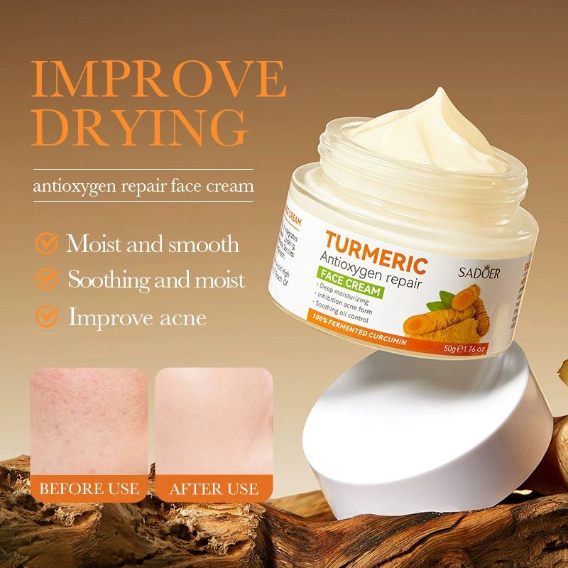SADOER 4PCS Turmeric Set:Tumeric Cleanser + Face Toner +Face Serum + Face Cream , with unparelled Vitamin C capabilities, Helps in Preven Acne, Sooth, Hydrate, Lighten Acne Marks