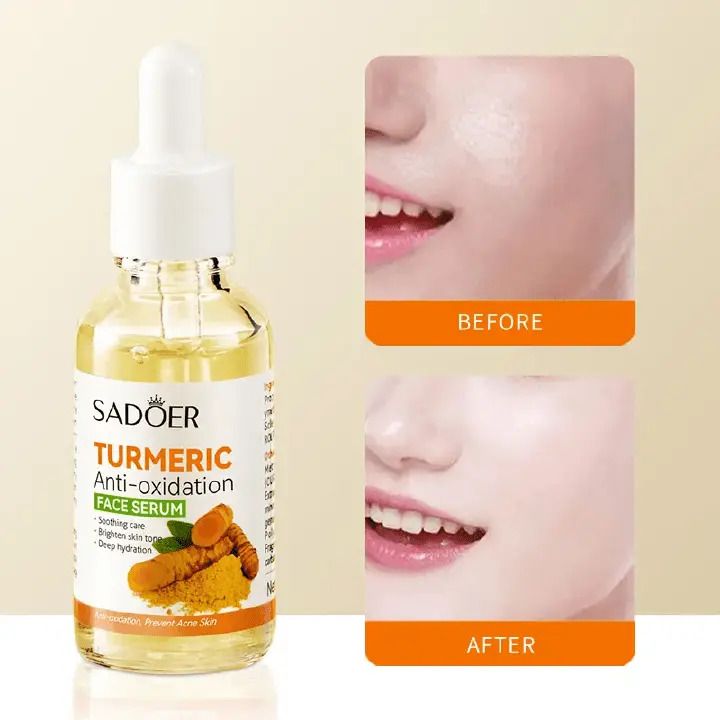 SADOER 4PCS Turmeric Set:Tumeric Cleanser + Face Toner +Face Serum + Face Cream , with unparelled Vitamin C capabilities, Helps in Preven Acne, Sooth, Hydrate, Lighten Acne Marks