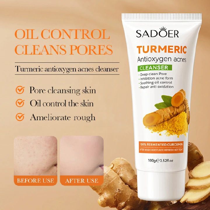 SADOER 4PCS Turmeric Set:Tumeric Cleanser + Face Toner +Face Serum + Face Cream , with unparelled Vitamin C capabilities, Helps in Preven Acne, Sooth, Hydrate, Lighten Acne Marks
