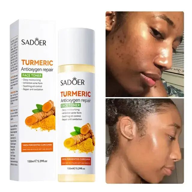 SADOER 4PCS Turmeric Set:Tumeric Cleanser + Face Toner +Face Serum + Face Cream , with unparelled Vitamin C capabilities, Helps in Preven Acne, Sooth, Hydrate, Lighten Acne Marks