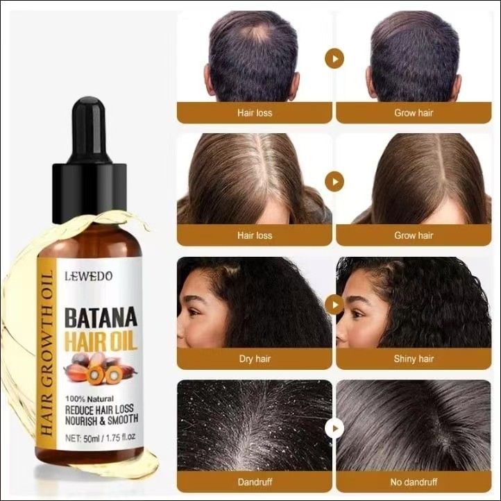 250G/ 120gFast Hair Growth Oil + Cream Africa Crazy Traction Alopecia batana Hair Mask Anti Hair Break Hair Strengthener Hair Loss Treatment Spray Upgrade to the larger-capacity version