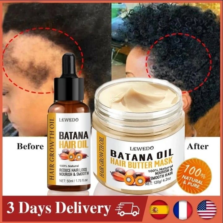 250G/ 120gFast Hair Growth Oil + Cream Africa Crazy Traction Alopecia batana Hair Mask Anti Hair Break Hair Strengthener Hair Loss Treatment Spray Upgrade to the larger-capacity version