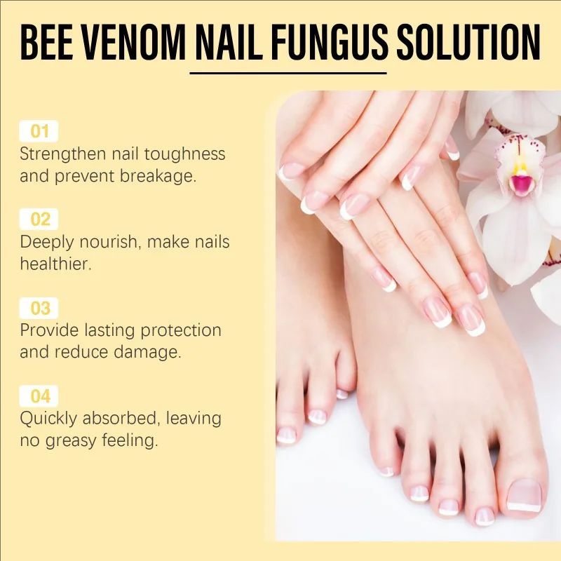 Bee Venom Fungal Nail Treatment Feet Care Essence Removal Fungus Healthy Repair Serum Anti Infection Paronychia Onychomycosis
