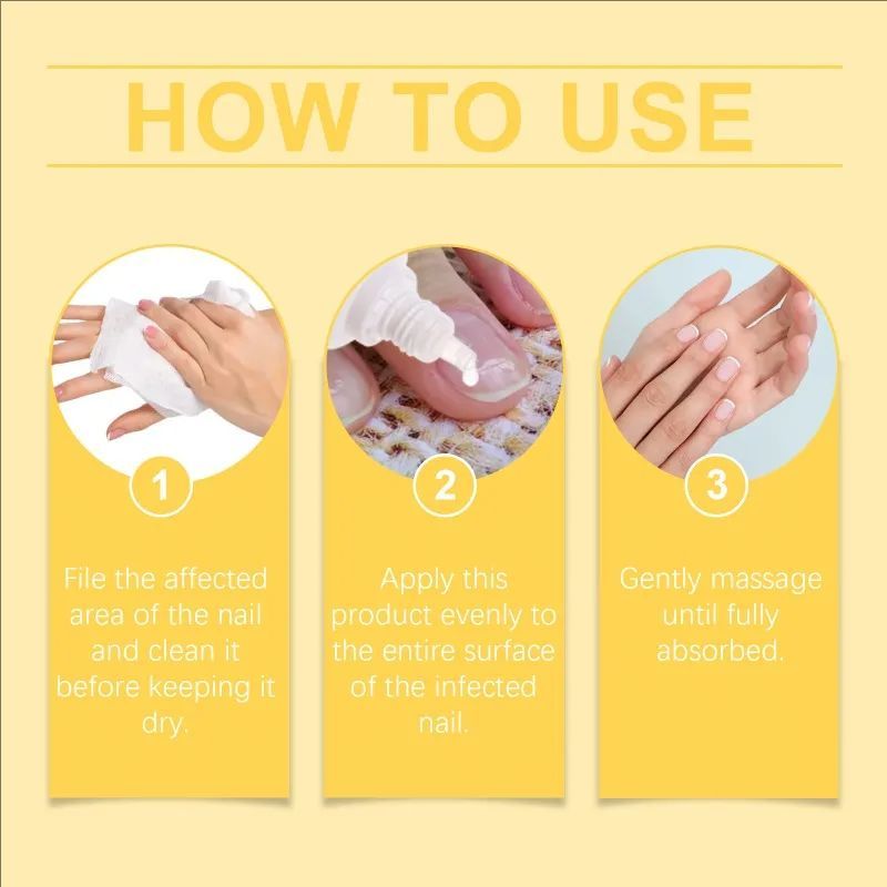 Bee Venom Fungal Nail Treatment Feet Care Essence Removal Fungus Healthy Repair Serum Anti Infection Paronychia Onychomycosis
