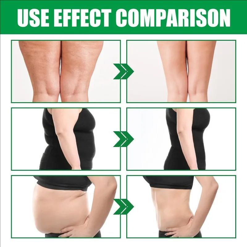 Body Shaping Firming Cream Big Belly Tighten Waist Shaping Lifting Arms Body Shaping Curves Slimming Obesity Fat Burning Cream