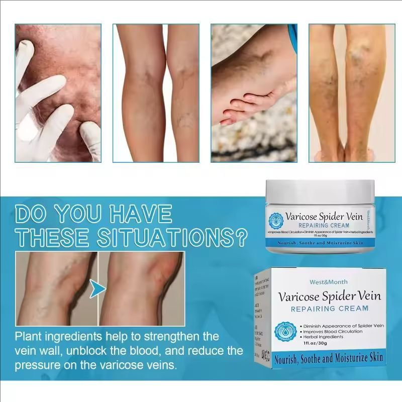 Varicose Vein Repair Cream Effective Relieves Leg Bulge Pain Treatment Cream Vasculitis Phlebitis Mprove Blood Circulation Cream