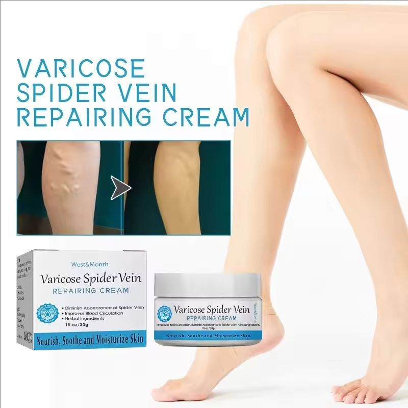 Varicose Vein Repair Cream Effective Relieves Leg Bulge Pain Treatment Cream Vasculitis Phlebitis Mprove Blood Circulation Cream