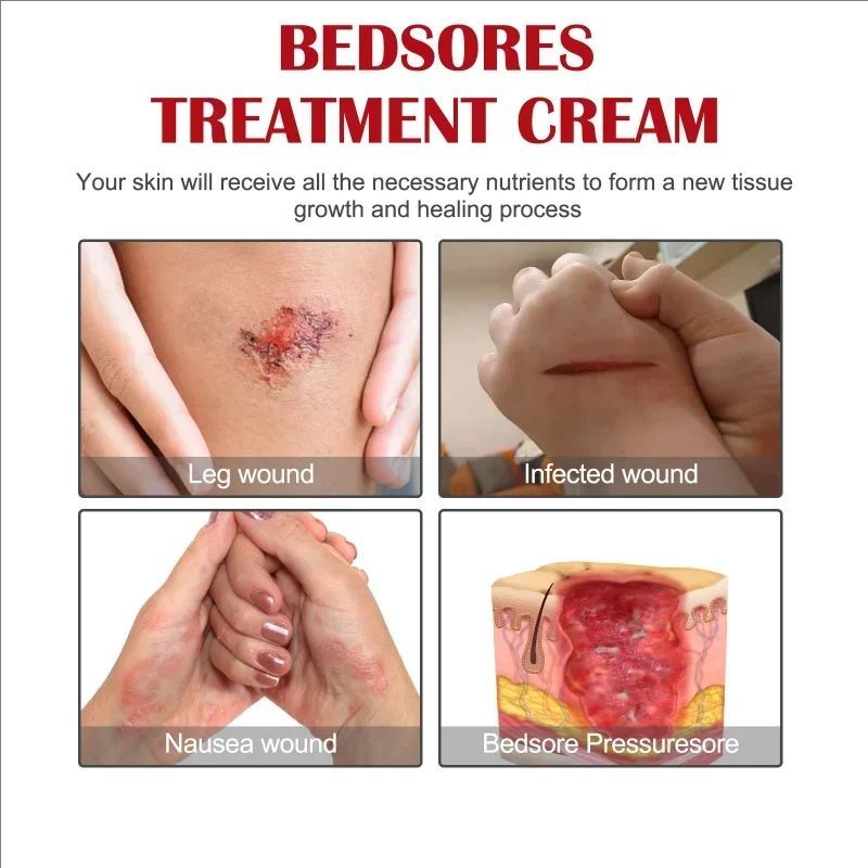 Decubitus Cream Pressure Sore Ulcer Skin Relief Ointment Bed Sore Wound Healing Treat Anti Dry Repair Moisturizing Body Care