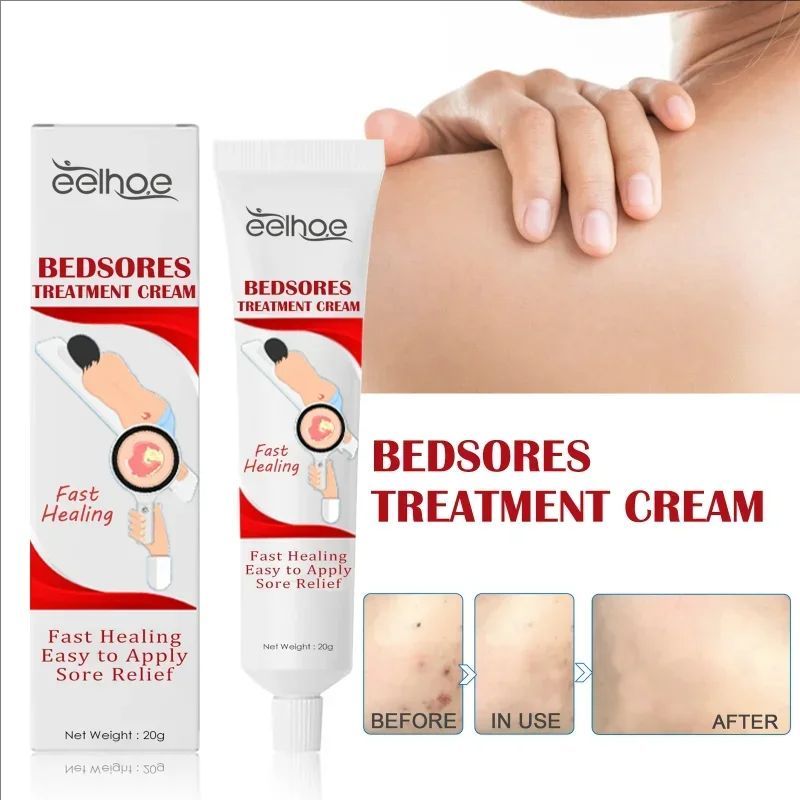 Decubitus Cream Pressure Sore Ulcer Skin Relief Ointment Bed Sore Wound Healing Treat Anti Dry Repair Moisturizing Body Care