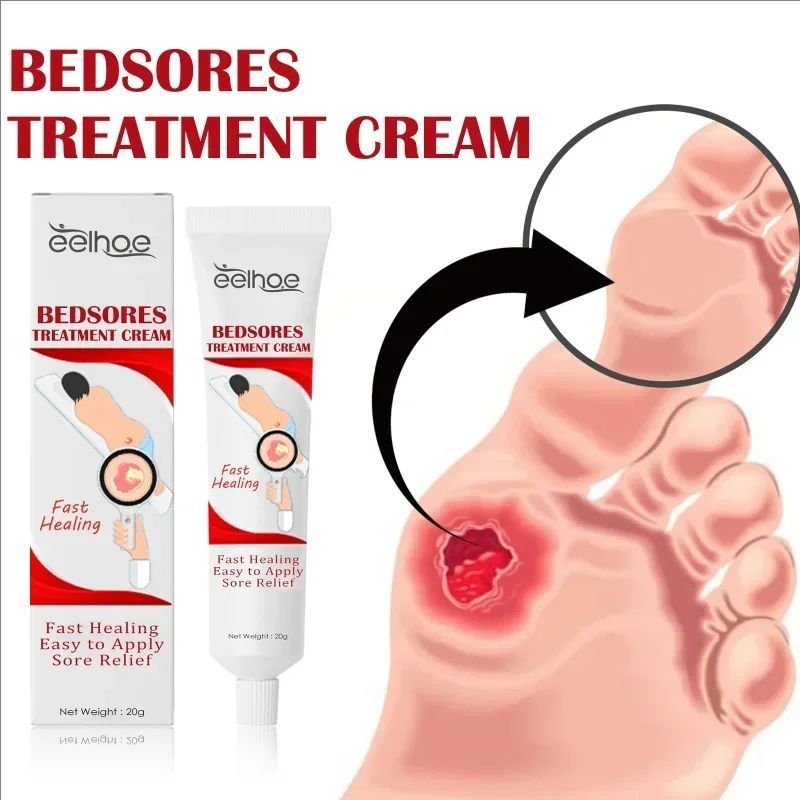 Decubitus Cream Pressure Sore Ulcer Skin Relief Ointment Bed Sore Wound Healing Treat Anti Dry Repair Moisturizing Body Care