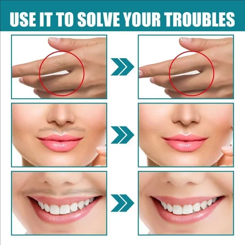 Permanent Lip hair removal cream gentle facial painless epilator face hair remover for women men lips Depilatory Wax Skin care