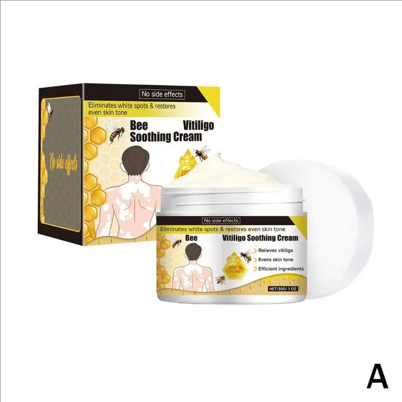 Vitiligo Treatment Cream Natural Relief Skin Treatment Eliminate Soothing Removal Pigment Ointment Vitiligo White Spot N8B4