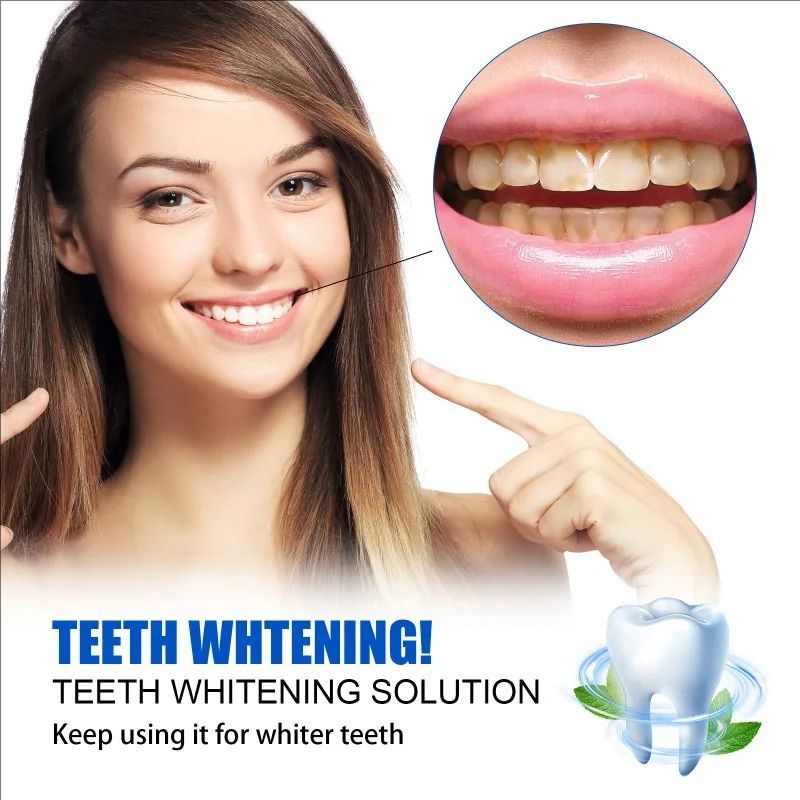 Teeth Whitening Essence Tooth Care Serum Anti-Yellow Remove Plaque Stains Oral Hygiene Cleaning Fresh Breath Teeth Care Products