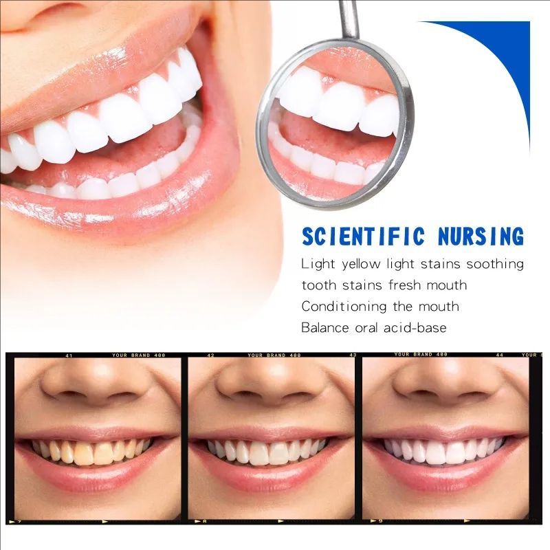 Teeth Whitening Essence Tooth Care Serum Anti-Yellow Remove Plaque Stains Oral Hygiene Cleaning Fresh Breath Teeth Care Products