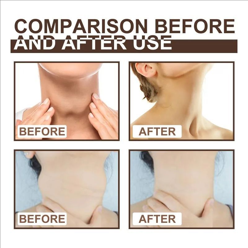 Lymphatic Detox Cream Relieve Lymph Nodes Swollenness Pain Treatment Behind Ears Neck Armpit Discomfort Body Care Ointment