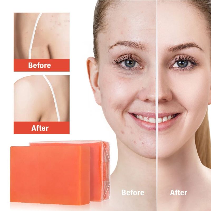 100g Kojic Acid Soap Original Skin Brightening Soap that Reduces Dark Spots Hyperpigmentation, Scars with Coconut & Tea Tree Oil