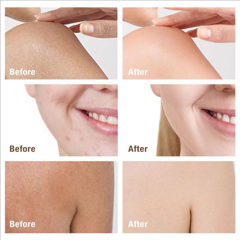 100g Kojic Acid Soap Original Skin Brightening Soap that Reduces Dark Spots Hyperpigmentation, Scars with Coconut & Tea Tree Oil