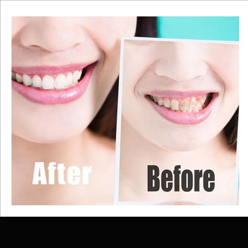 14pcs/box Teeth Whitening Strip Charcoal Teeth Whitening Strips Remove Coffee Tea Stains Tooth Whitening Kit Dental Bleaching