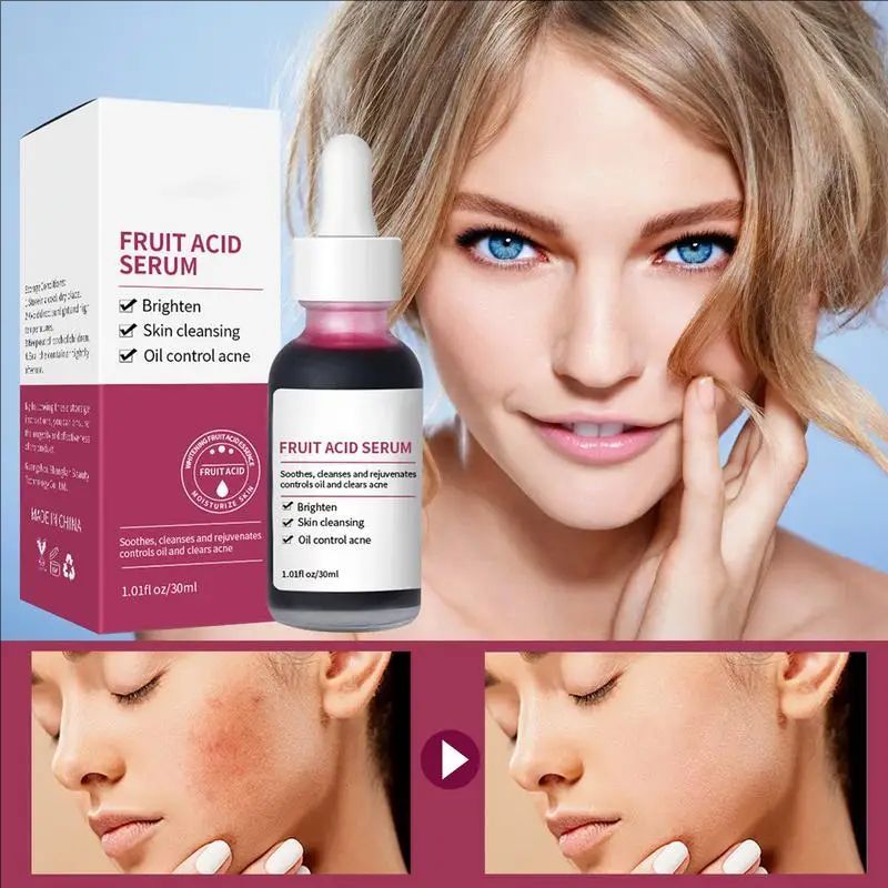 30ml Pore Shrinking Serum Fruit Acid Essence face serum Smooth Pores Brighten Oil Control Moisturizing Skin Care Product