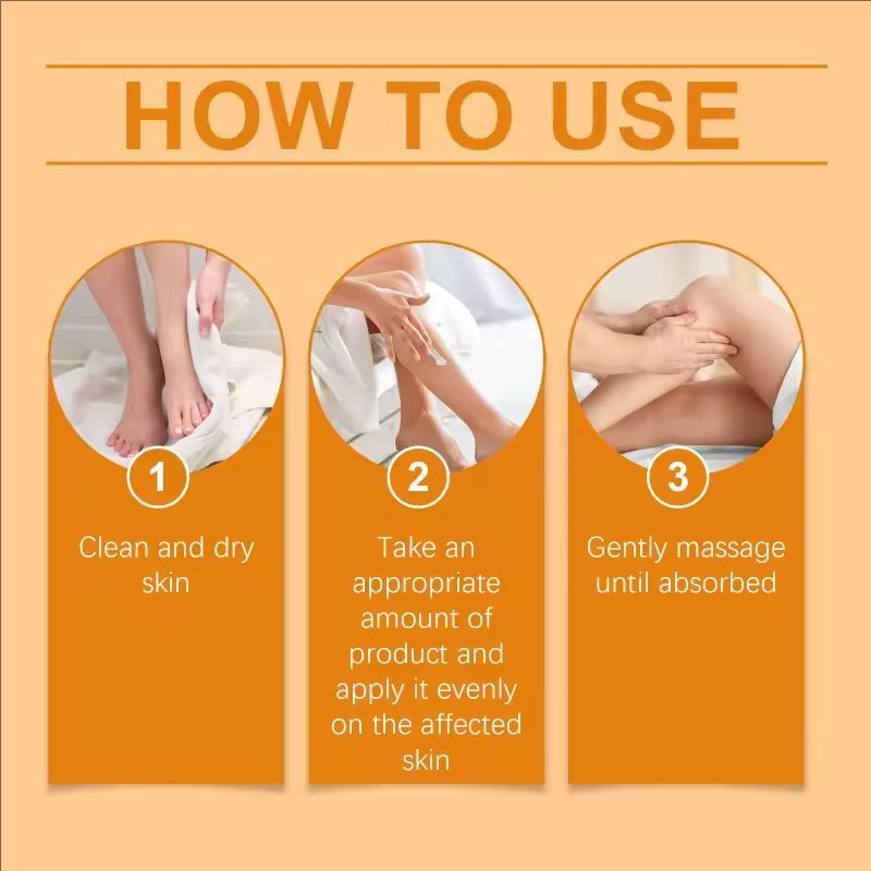 Bee Venom Varicose Vein Repair Cream Tongmai Effective Relieves Leg Bulge Pain Treatment Cream Vasculitis Phlebitis Cream 20g