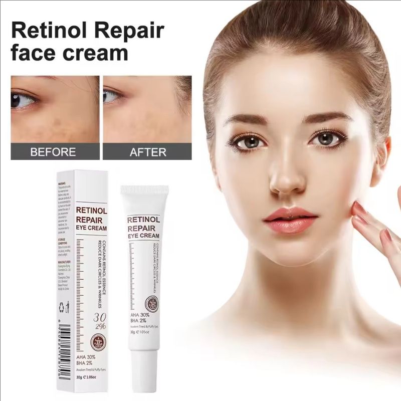 Retinol Eye Wrinkles, Fine Lines, Wrinkles, Eye Bags And Dark Spots, Retinol Eye, Eye Care, Eliminates Eye Bags Gifts