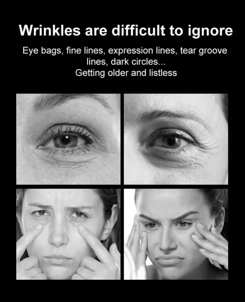 Retinol Eye Wrinkles, Fine Lines, Wrinkles, Eye Bags And Dark Spots, Retinol Eye, Eye Care, Eliminates Eye Bags Gifts