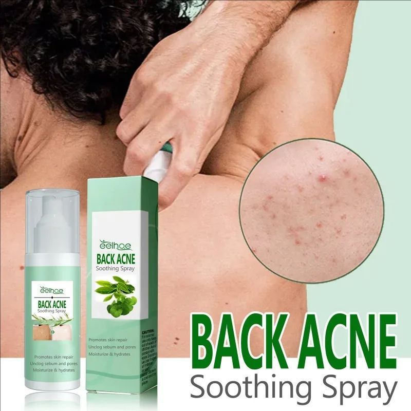 Back Acne Repair Spray Acne Removal Essence Oil Oil Butt Shoulder Care Cream Control Back Whitening Moisturize Removal Spray