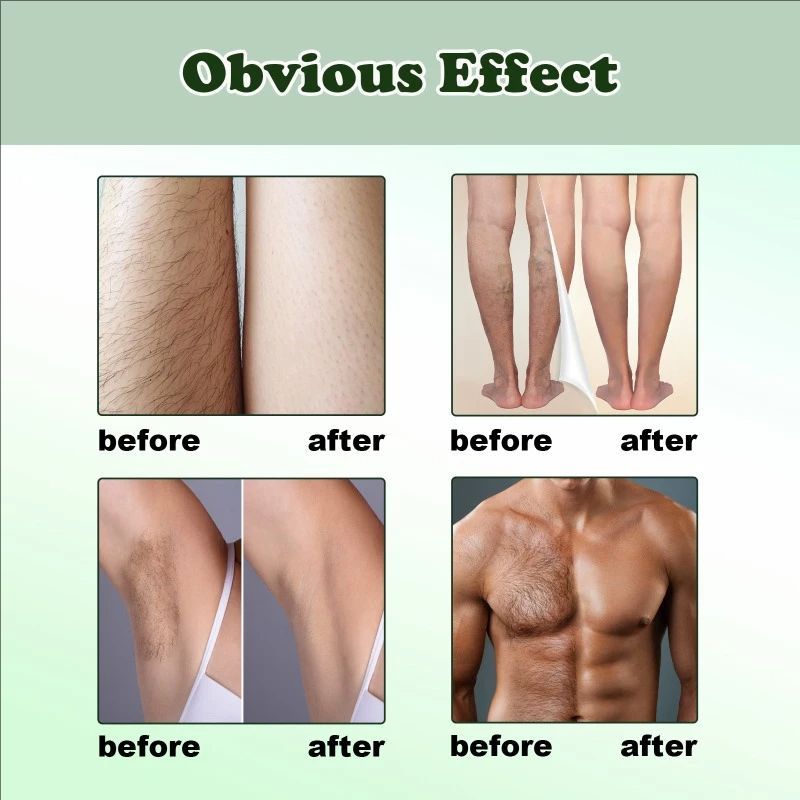 Painless Hair Remover Spray Gentle Non-irritating Armpit Hand Leg Hair Without Leaving Black Spots Moisture Body Care Depilatory