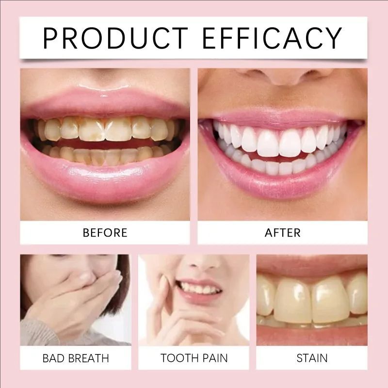 Probiotic Toothpaste SP-6 Toothpaste Cleaning Teeth Refreshing Breath Oral Cleaning Anti-Yellow Toothpaste Teeth Care Products