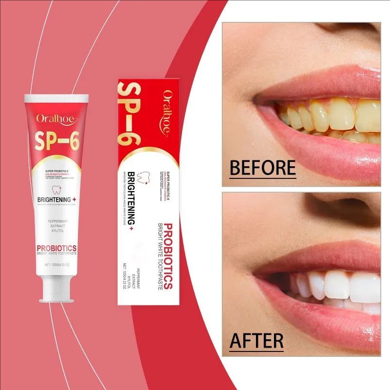 Probiotic Toothpaste SP-6 Toothpaste Cleaning Teeth Refreshing Breath Oral Cleaning Anti-Yellow Toothpaste Teeth Care Products