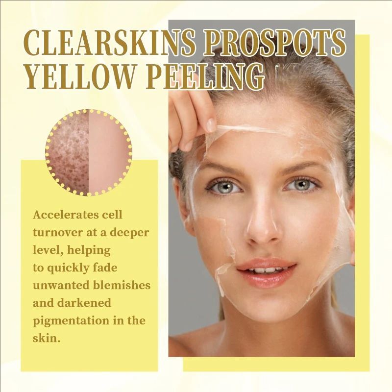 Peeling Oil Elbow Knee Yellow Oil Skin Brighten deep cleansing exfoliating fade Spots Moisturizing whitening Remove Dead skin