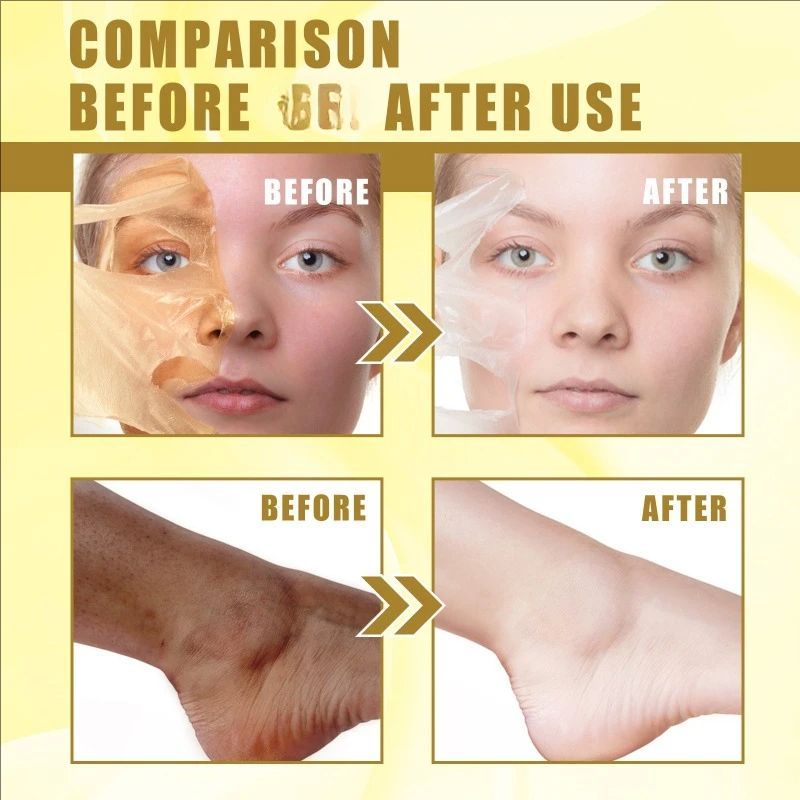 Peeling Oil Elbow Knee Yellow Oil Skin Brighten deep cleansing exfoliating fade Spots Moisturizing whitening Remove Dead skin