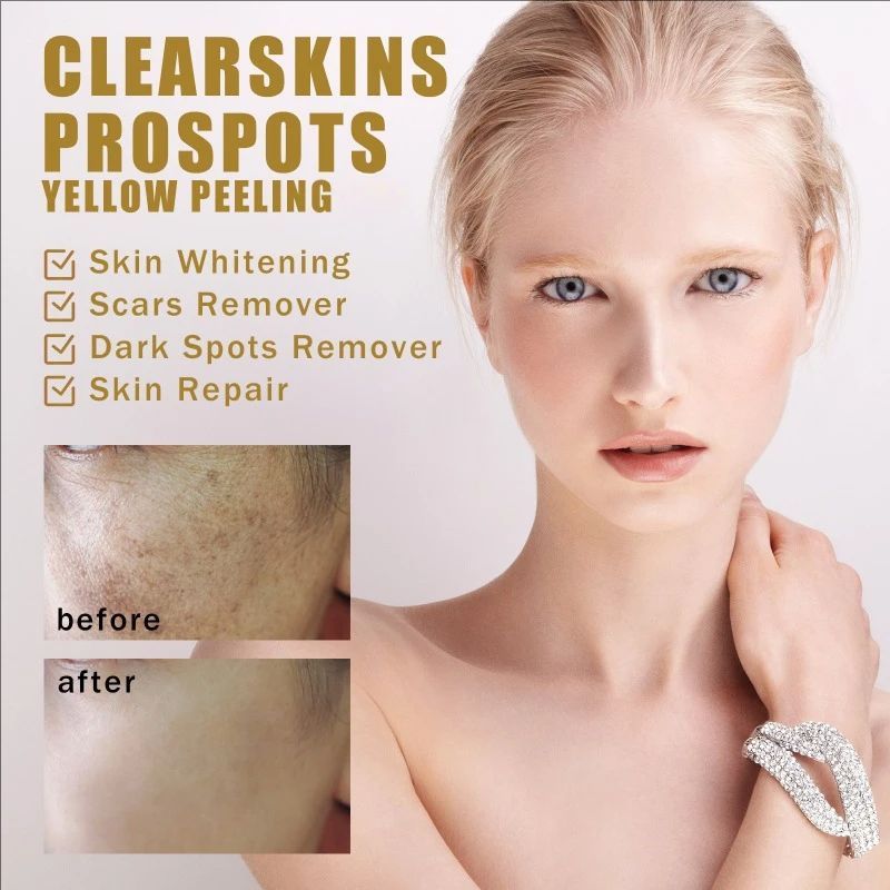 Peeling Oil Elbow Knee Yellow Oil Skin Brighten deep cleansing exfoliating fade Spots Moisturizing whitening Remove Dead skin