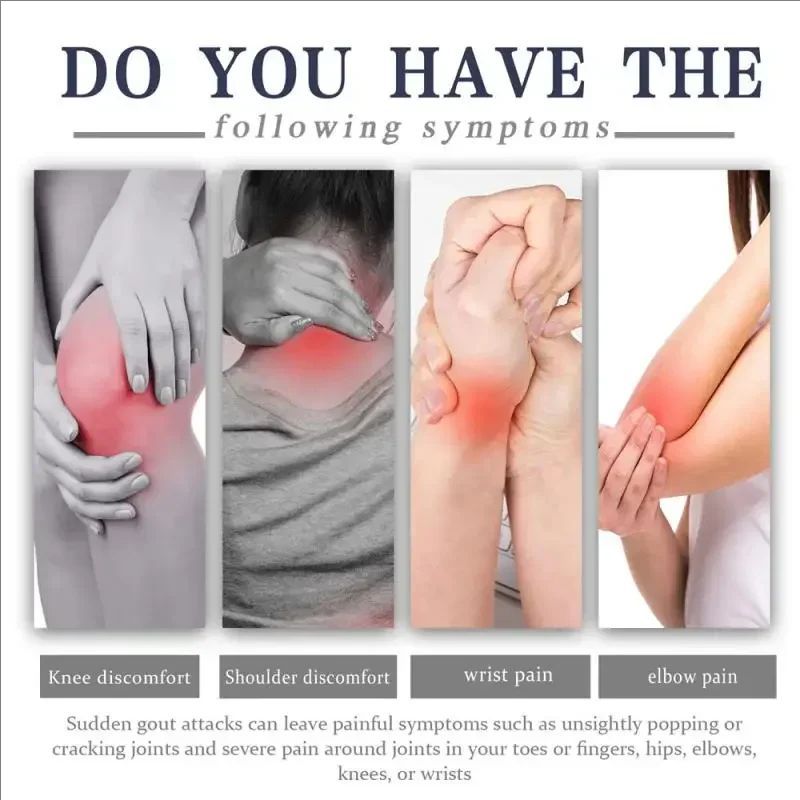 30g Bee Venoms Joint Cream Joint And Bone Therapy Cream Massage Treatments Cream Bone Health Body Care Tools Joint Bone Cream