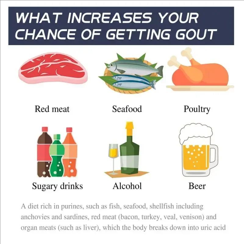 30g Bee Venoms Joint Cream Joint And Bone Therapy Cream Massage Treatments Cream Bone Health Body Care Tools Joint Bone Cream